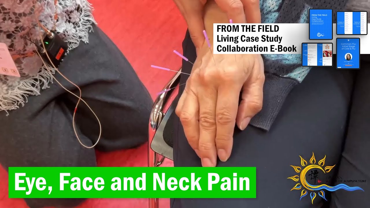 Eye Cheek & Neck Pain #neckpain  #eileenhan #balancemethodacupuncture #譚針 #韓玉齡 #eyepain #shoujinwu