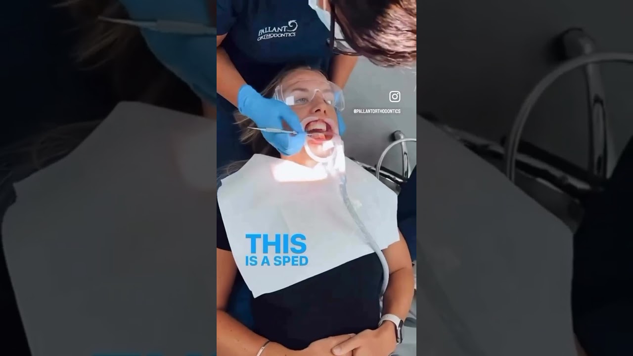 Hybrid braces!