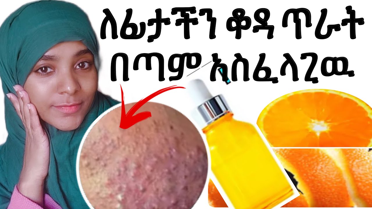 🌸ለፊታችን ቆዳ ጥራት በጣም አስፈላጊዉ ቪታሚን ሲ ሴሩም በቤት ዉስጥ #How to make vitamin c serum at home