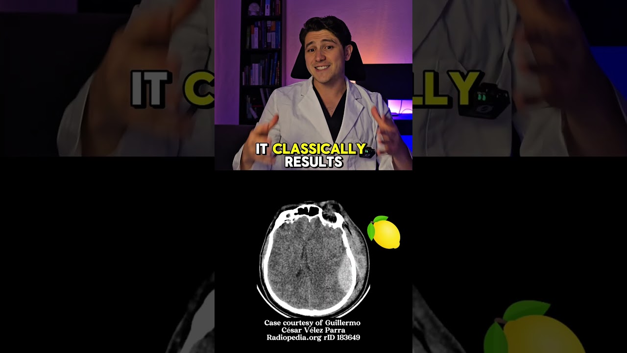 How to recognize Brain Bleeds on CT