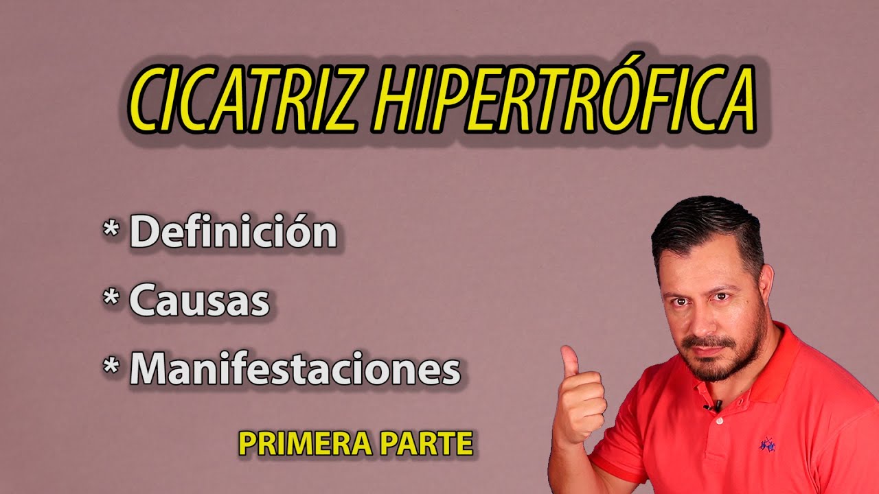 💥 CICATRIZ Hipertr&oacute;fica | Qu&eacute; es?. PARTE 1.