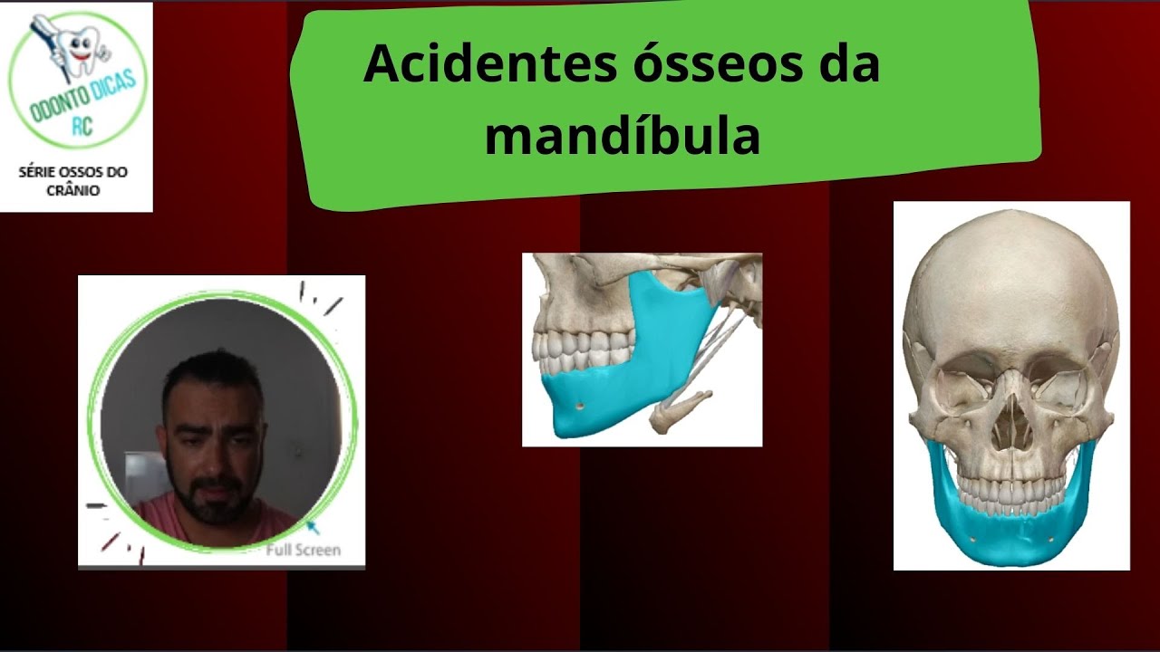 Ossos do crânio: acidentes ósseos da mandíbula 8/8