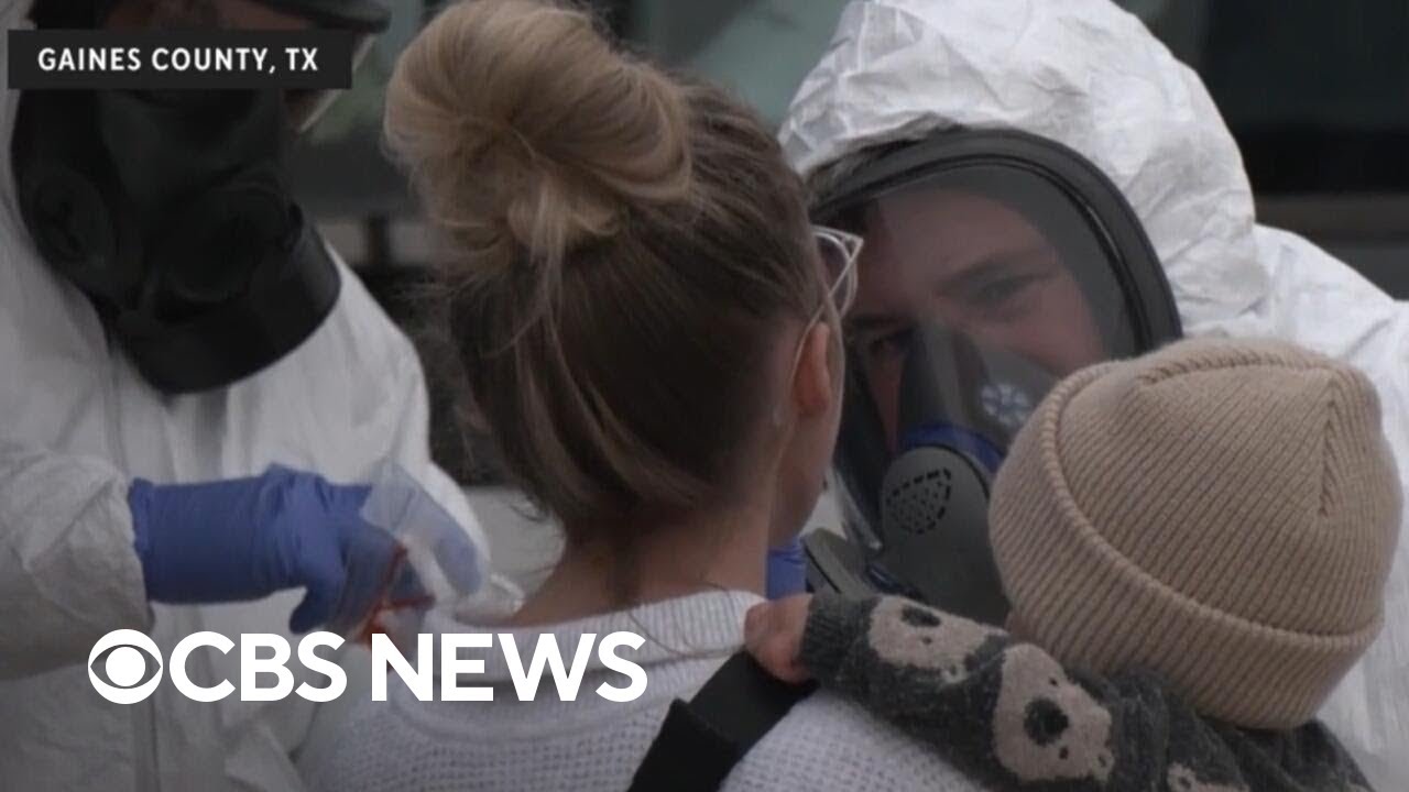 Doctor says Texas measles outbreak is 