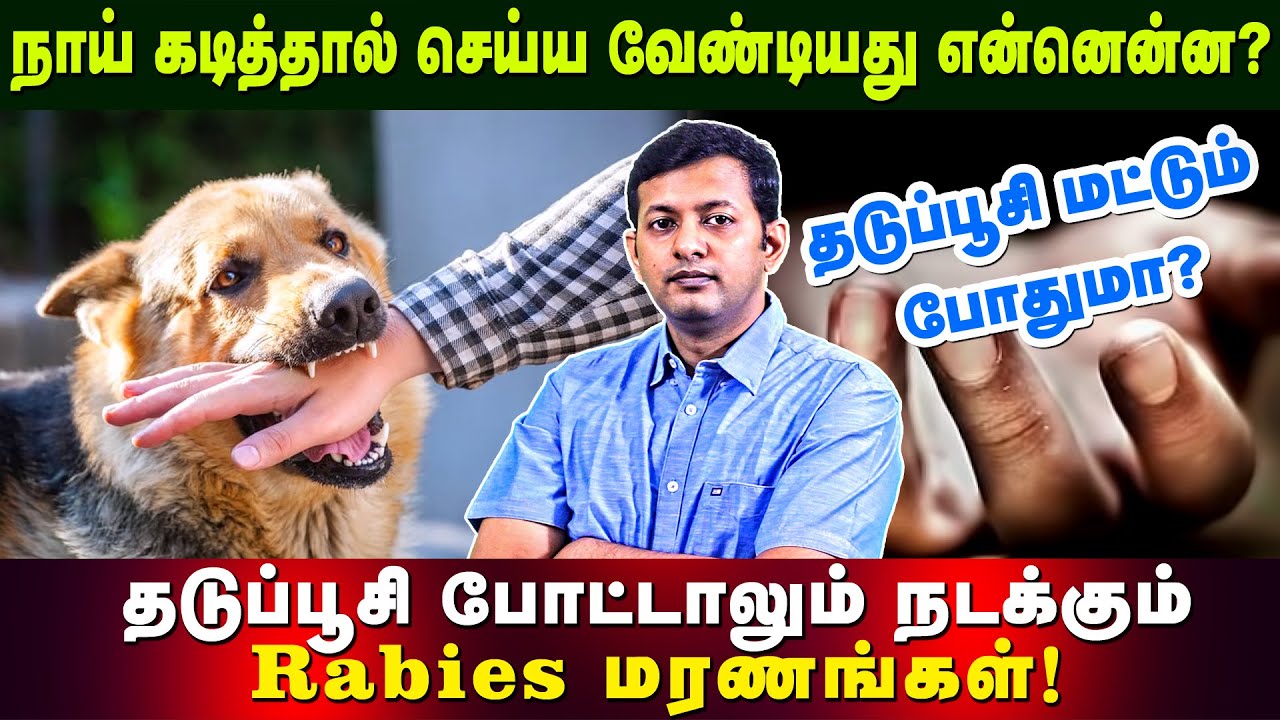 What to do after dog bite? when to vaccinate? Is vaccination alone enough? | Dr. Arunkumar