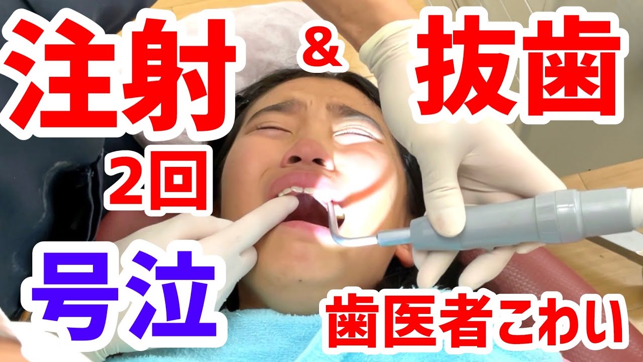 【号泣】緊急で歯医者さんへ。麻酔が効かずにまさかの注射2回連続に心折れる。歯を抜きます！