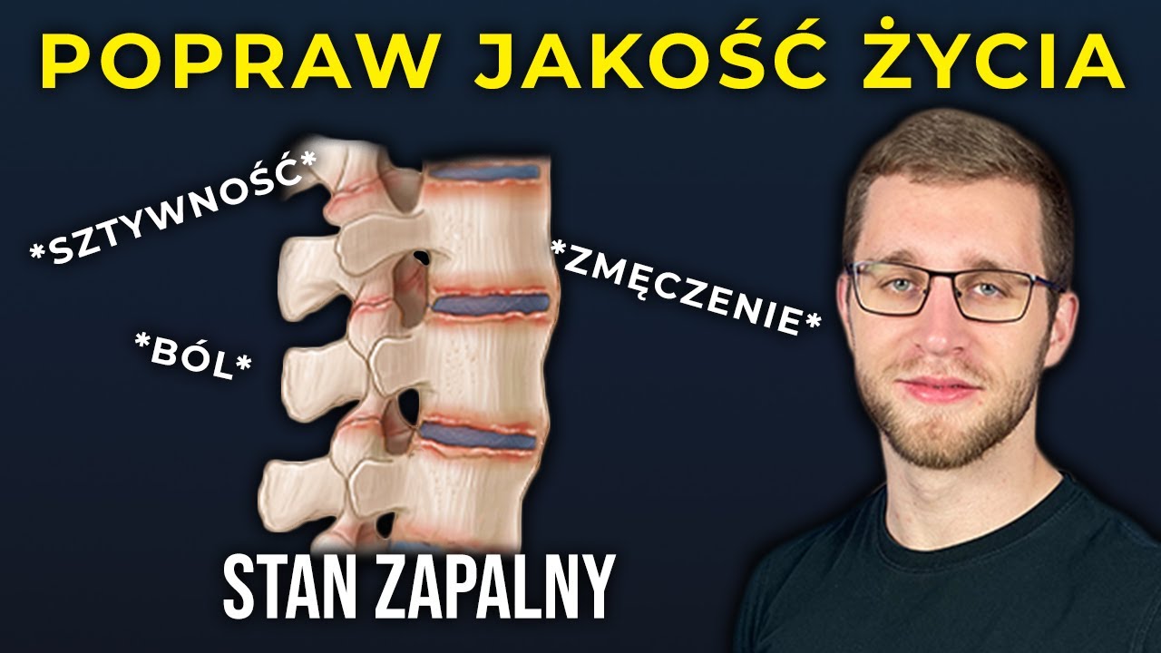 Reumatyzm Powodem B&oacute;lu Plec&oacute;w? ➜ Rehabilitacja | Ćwiczenia, Aktywność