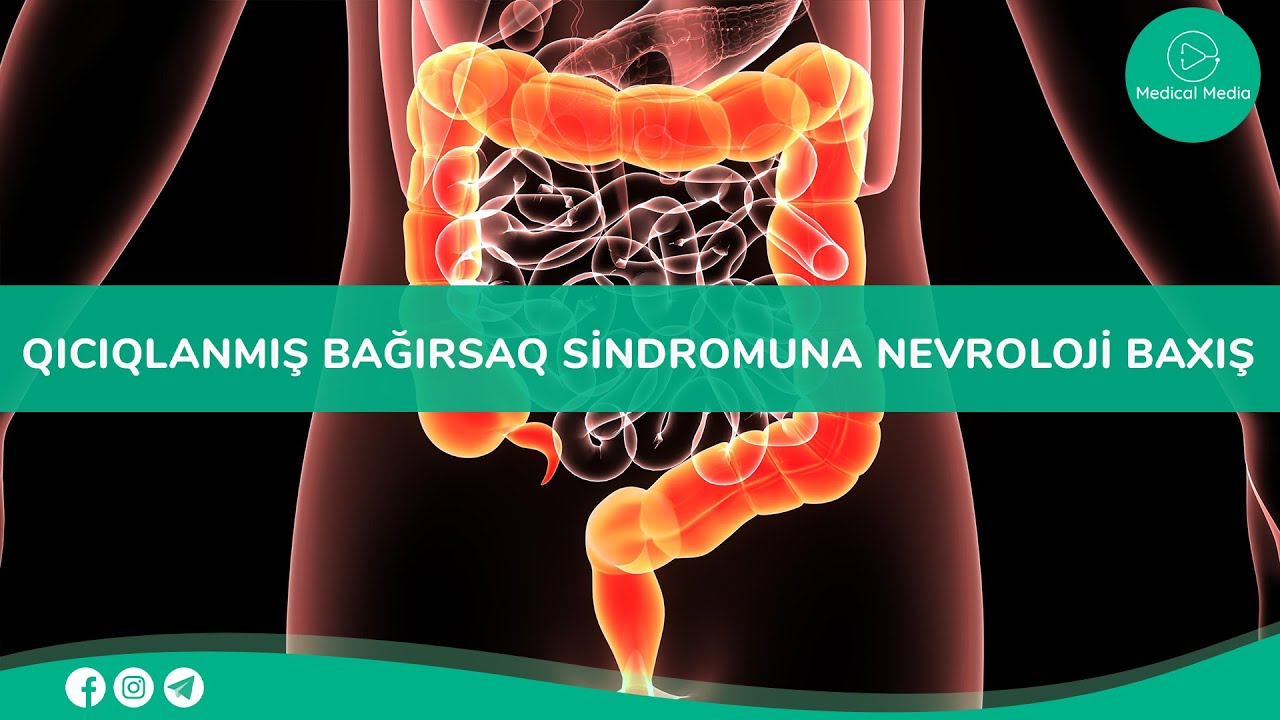 Qastroenteroloqun qəbulu - Qıcıqlanmış bağırsaq sindromuna nevroloji baxış