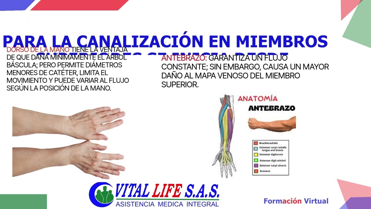 Técnica de inserción de catéter venoso, Manejo de la vía venosa y Prevención de Flefibits