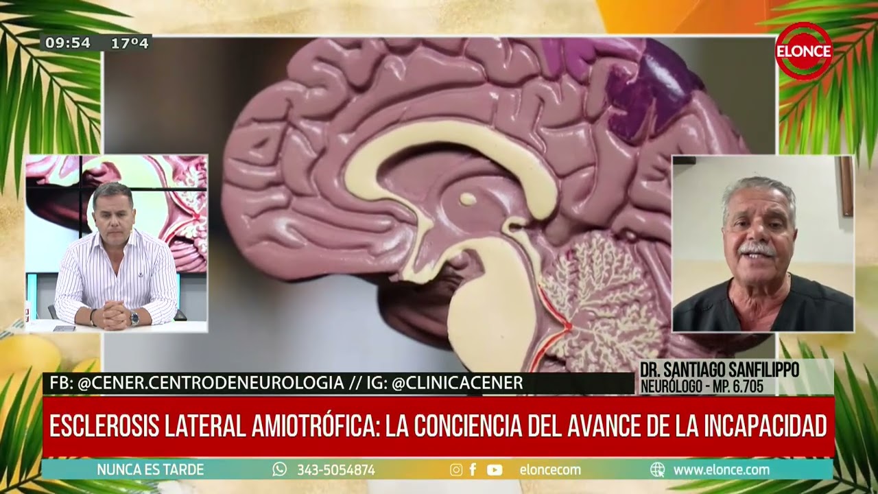Esclerosis lateral amiotrófica: señales de un enemigo silencioso - Dr. Santiago Sanfilippo 03/03/26
