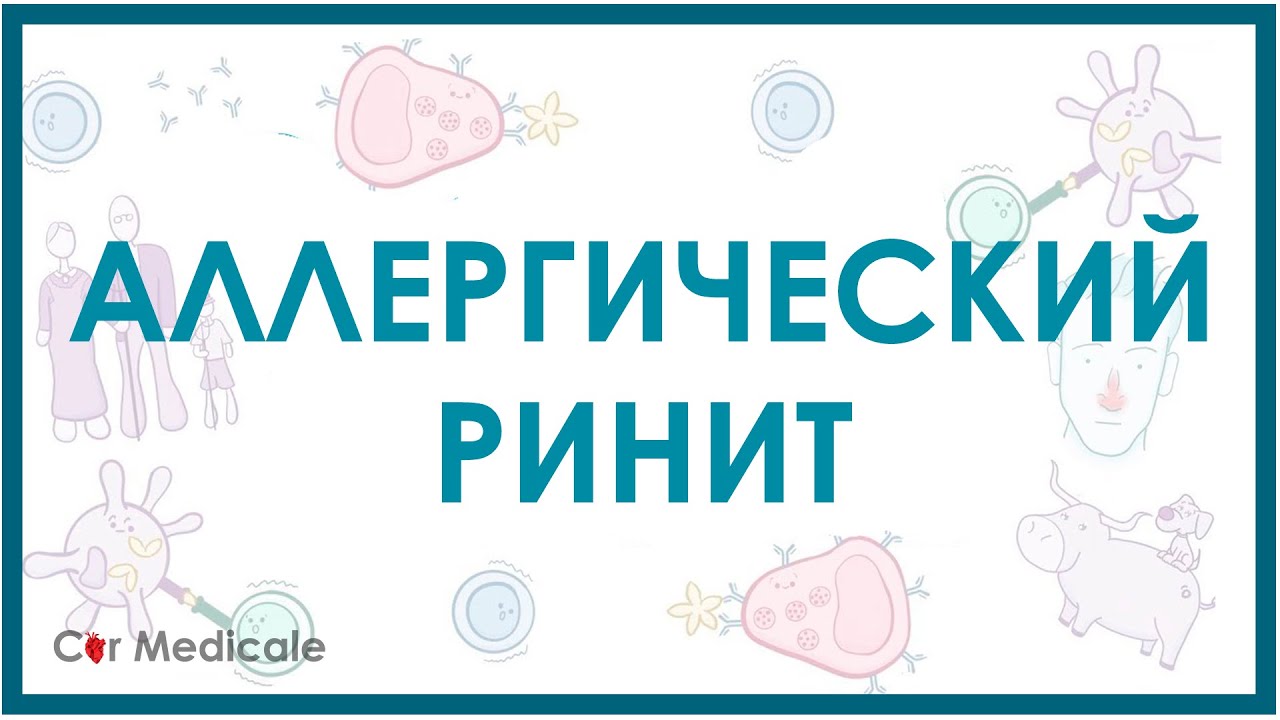 Аллергический ринит - причины, симптомы, лечение
