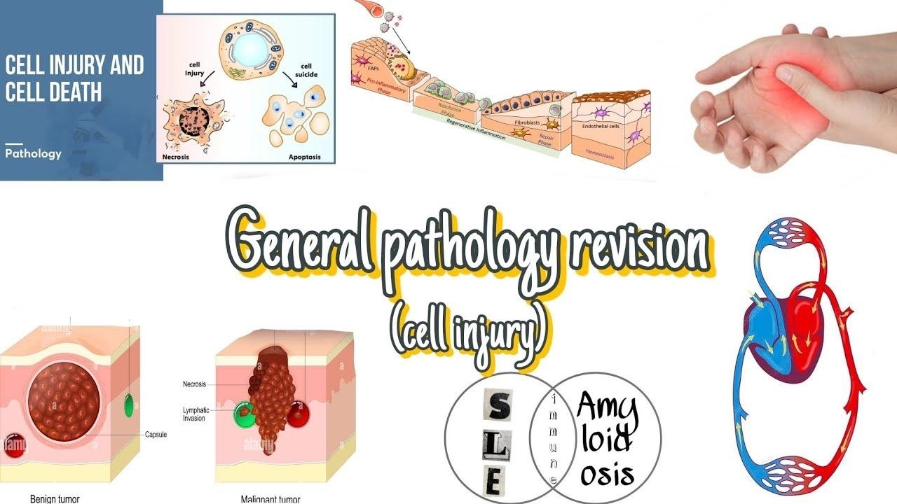General pathology | Cell injury revision