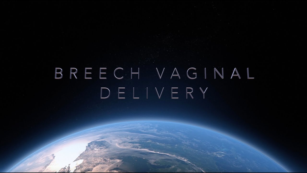 Breech Vaginal Delivery