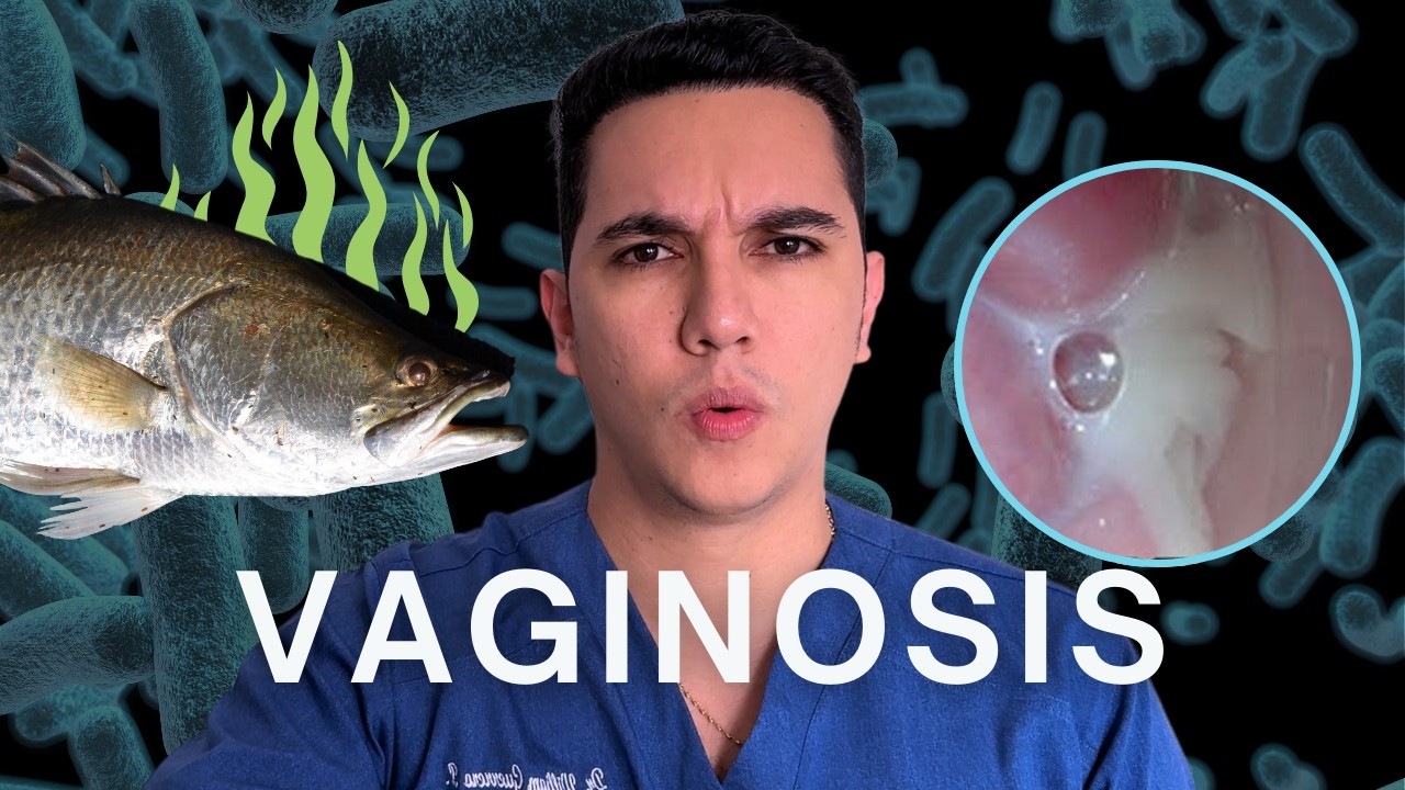 ¿Flujo vaginal de olor a pescado? Puedes tener vaginosis bacteriana | Dr. William Guerrero