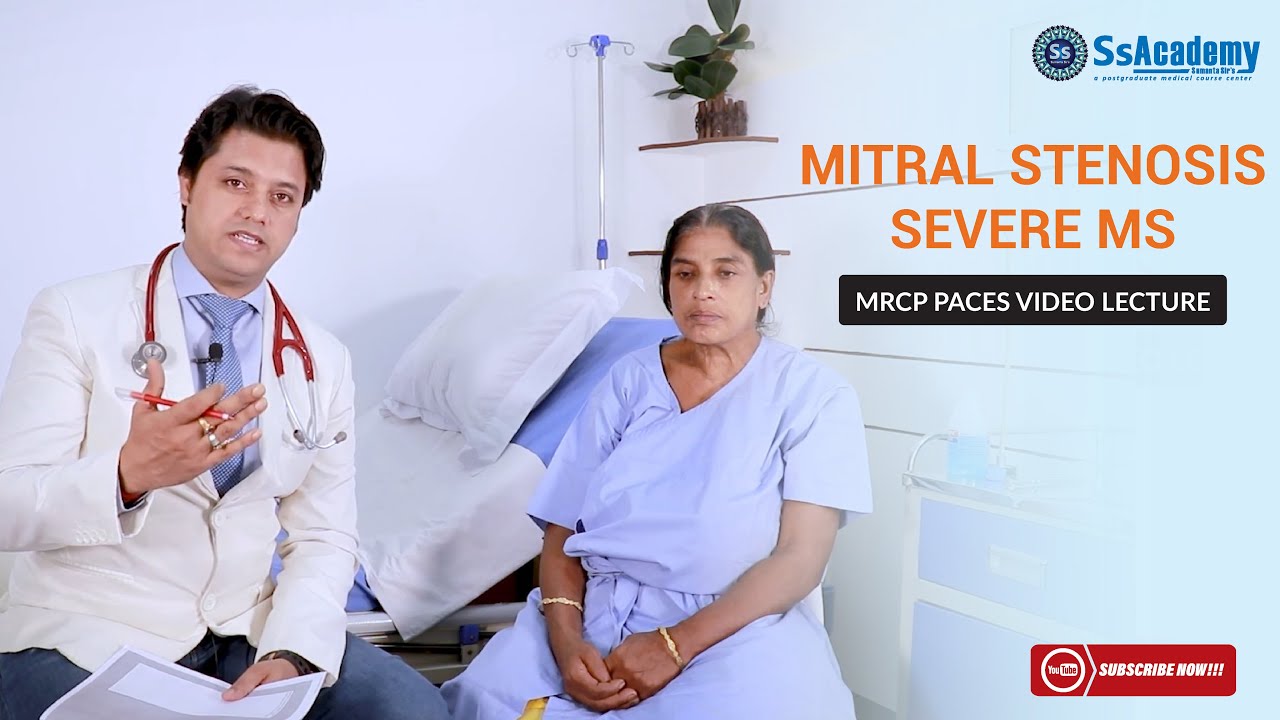 MRCP PACES (Clinical Case) - Cardiology - Severe Mitral Stenosis (MS)