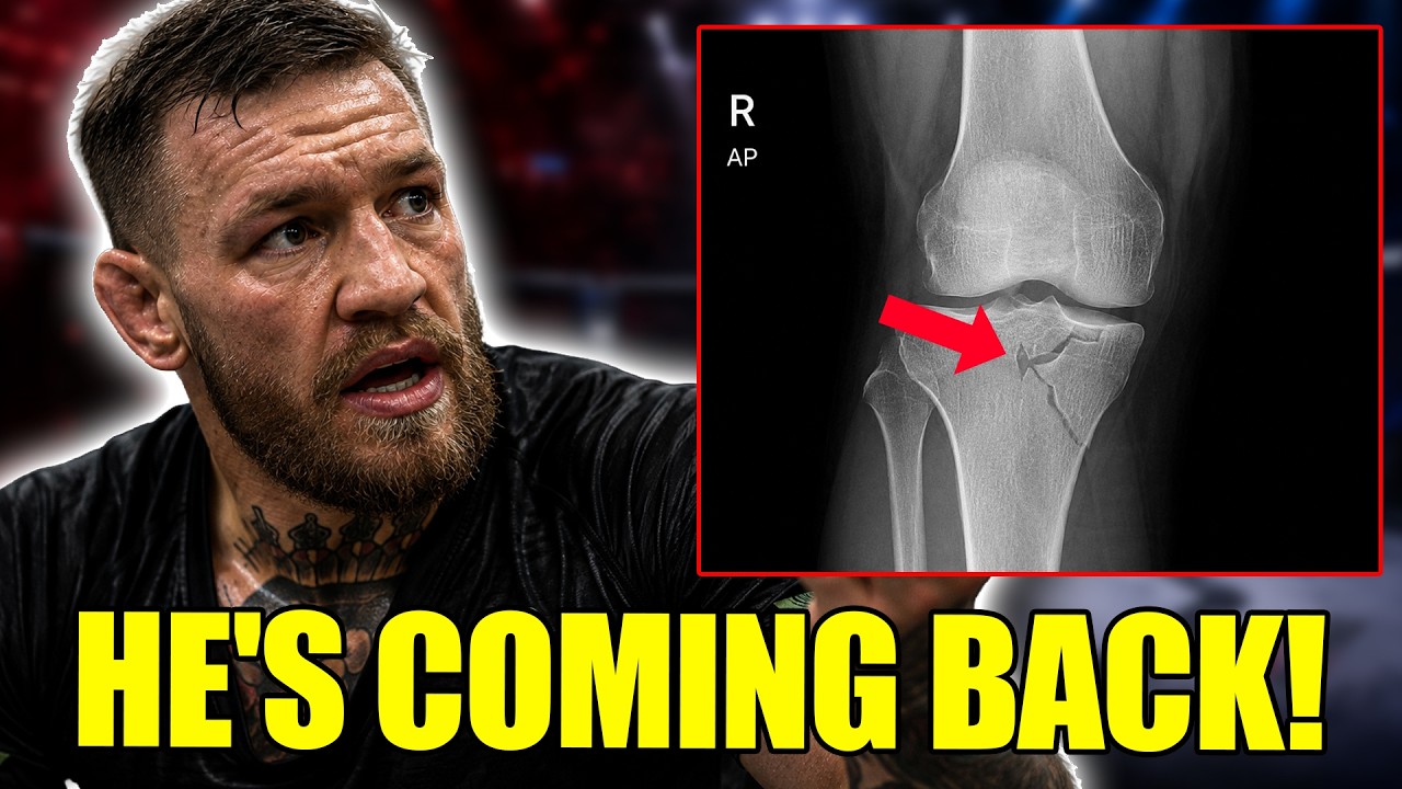 MMA World Is SHOCKED by Conor McGregor&rsquo;s Recovery Update!