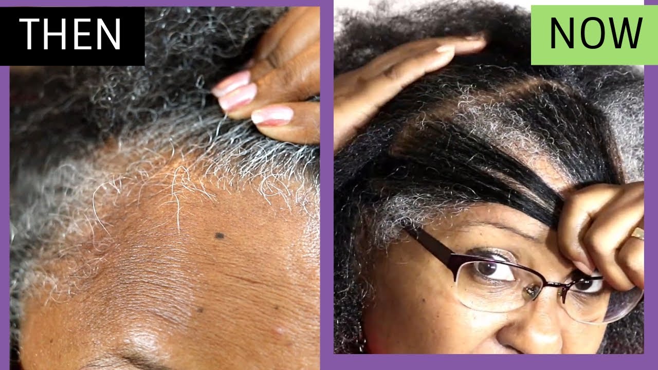 Обновление «Growing My Edges» | Удобрение для волос Virgin