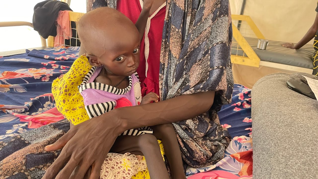 Kinderen sterven van de honger in Sudan en buurland Zuid-Sudan