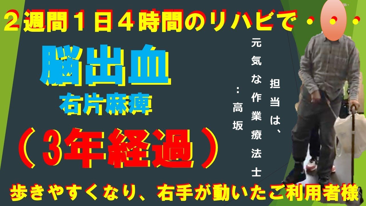 脳出血、右片麻痺、３年経過、２週間の短期集中（1日4時間）のリハビリで劇的変化！