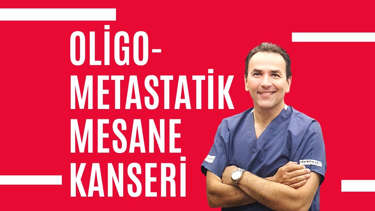 Oligometastatik Mesane Kanserinde Tedavi Seçenekleri (İleri Evre Mesane Kanseri Tedavisi)