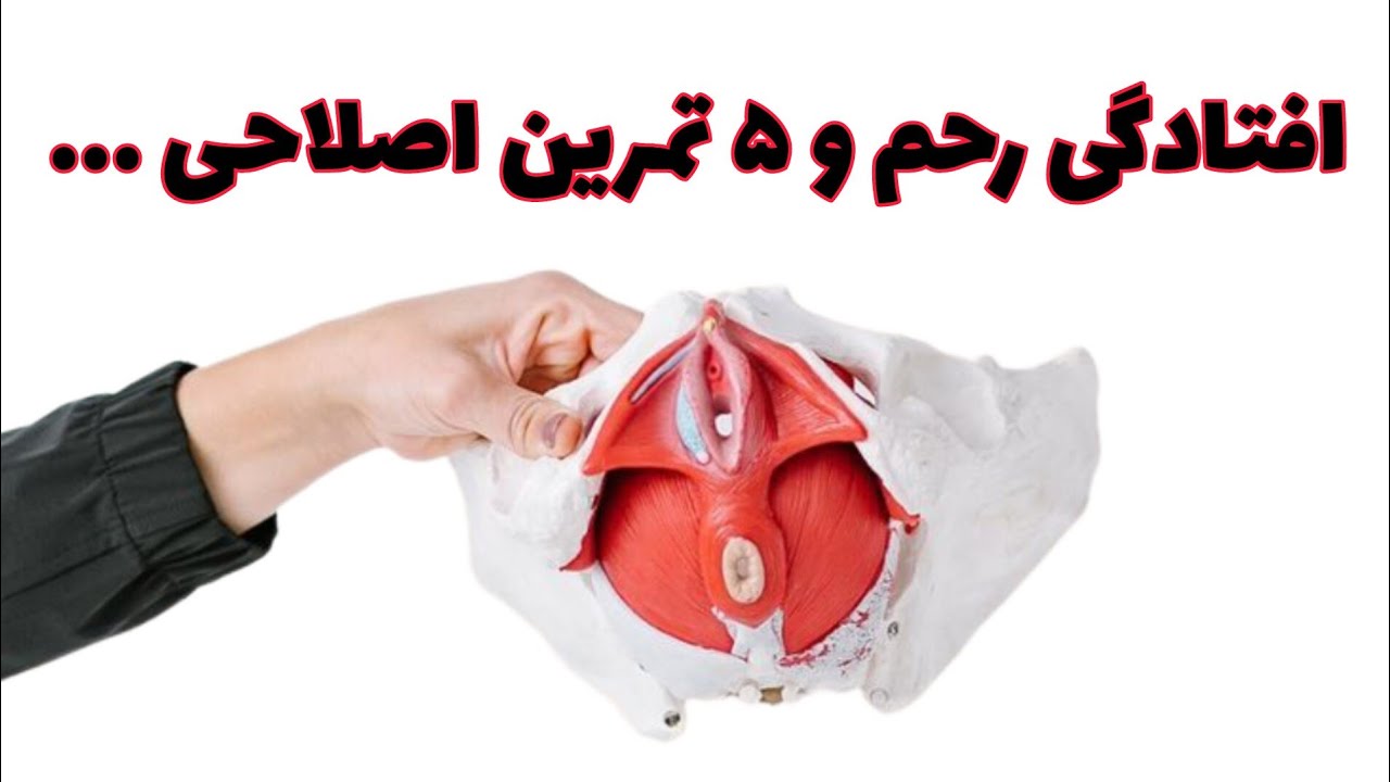 افتادگی رحم چیست؟درمان بدون جراحی با تمرینات علمی