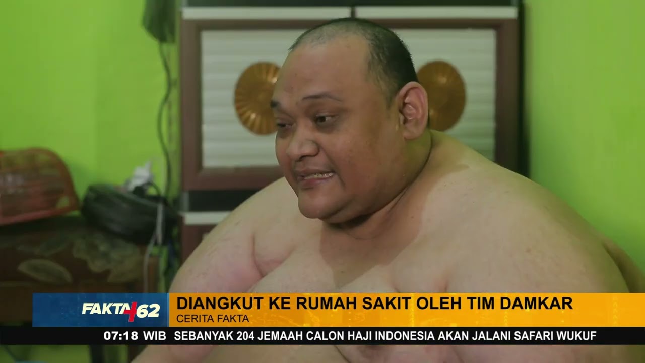 Perjuangan Hidup Orang yang Jadi Penderita Obesitas - FAKTA+62