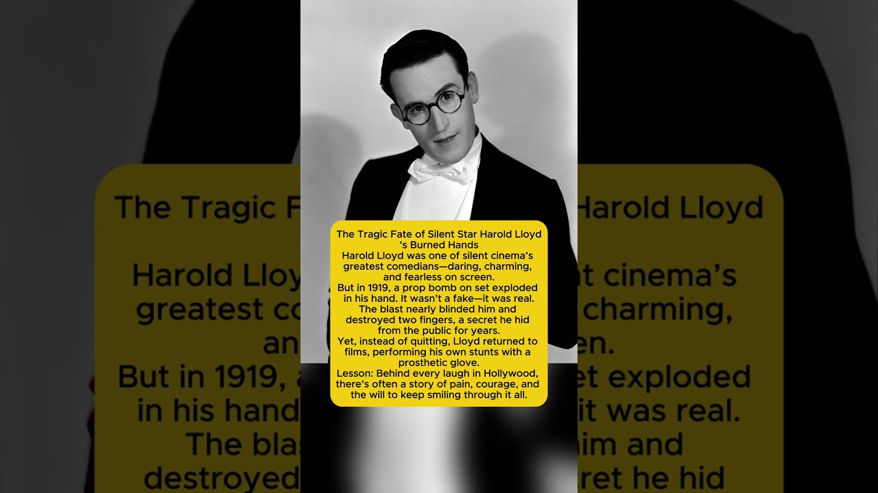 The Tragic Fate of Silent Star Harold Lloyd&rsquo;s Burned Hands | Hollywood&rsquo;s Untold Story