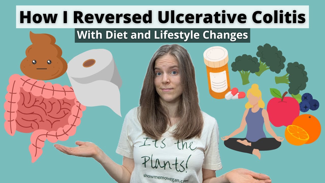 How I Healed My Ulcerative Colitis with Diet and Lifestyle
