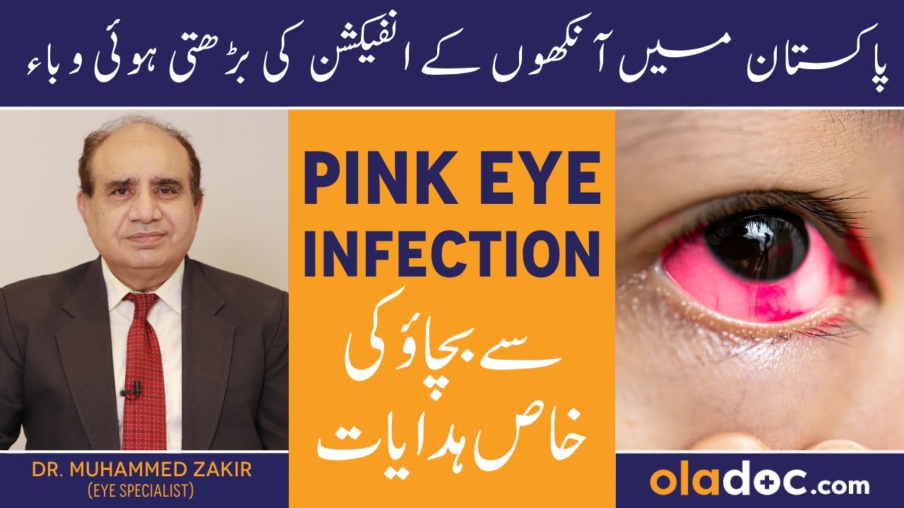 PINK EYE INFECTION IN PAKISTAN - Conjunctivitis Hone Se Kaise Bache- Eye Infection Treatment In Urdu