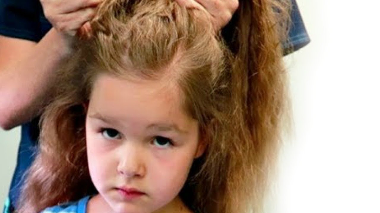 LICE!!!