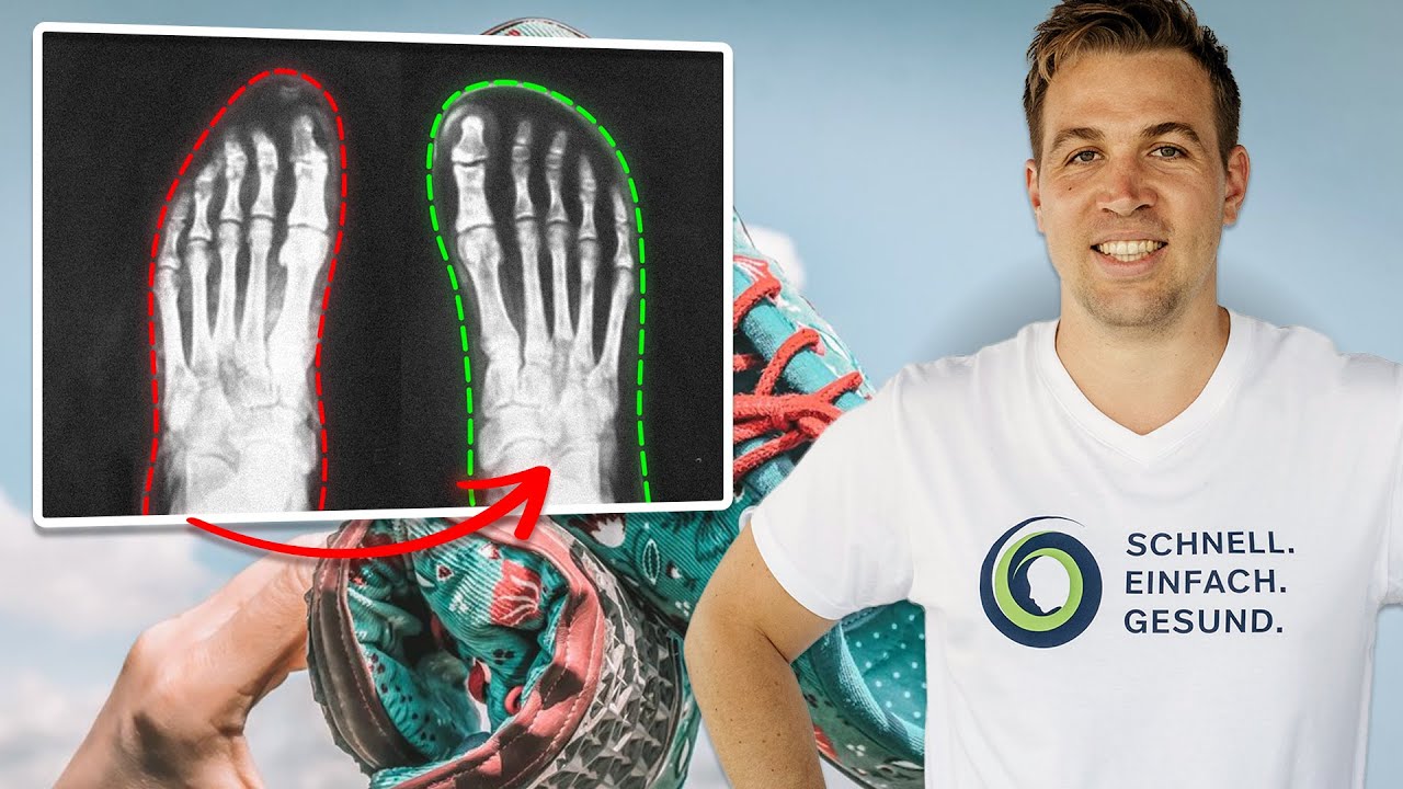 Mein Fazit nach 10 Jahren Barfußschuhen | Die besten Barfußschuhe