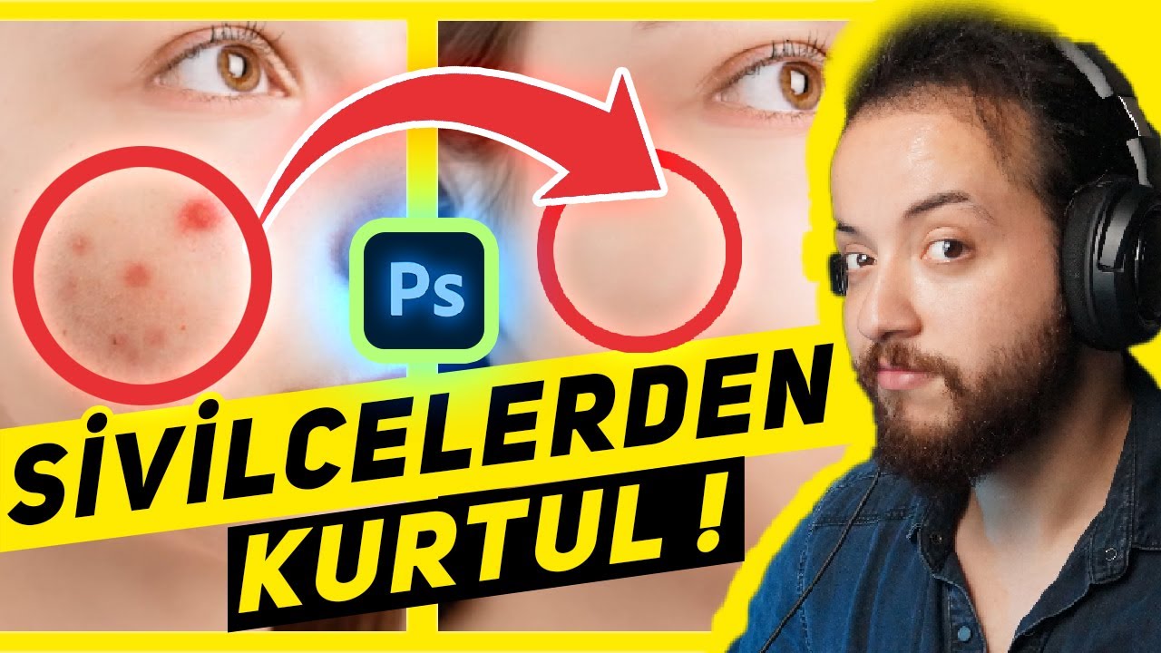 Adobe Photoshop ile Sivilce Temizleme Nasıl Yapılır? (EN BASİT YÖNTEM)