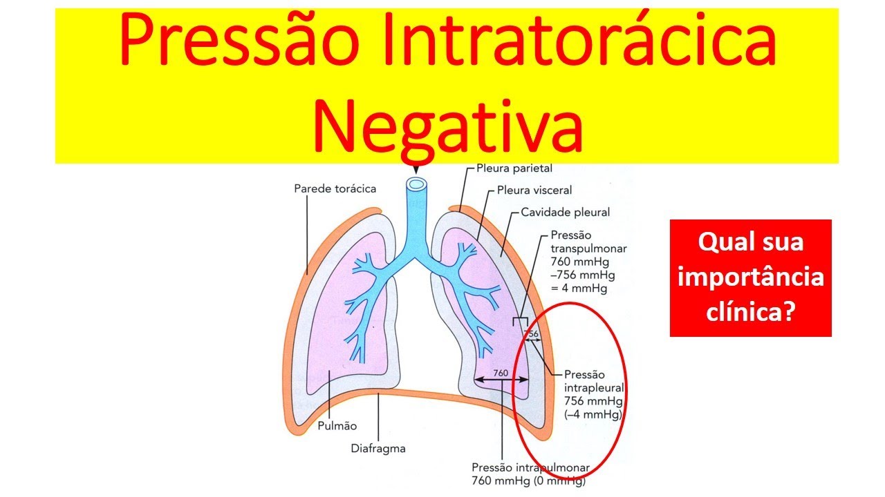 O que é Pressão Intratorácica Negativa?