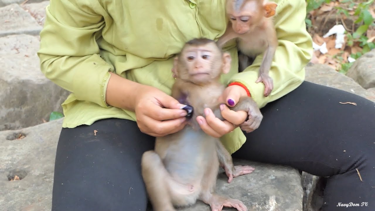 Witness the Continued Treatment of Abandoned Samuel (Polee)'s hand with Purple Lotion!