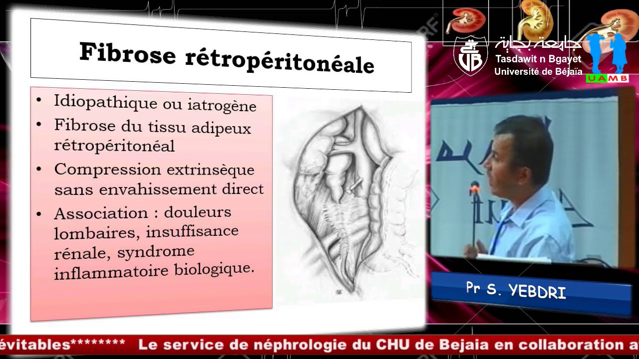 Communication du Pr S. YEBDRI, CHU Tizi-Ouzou