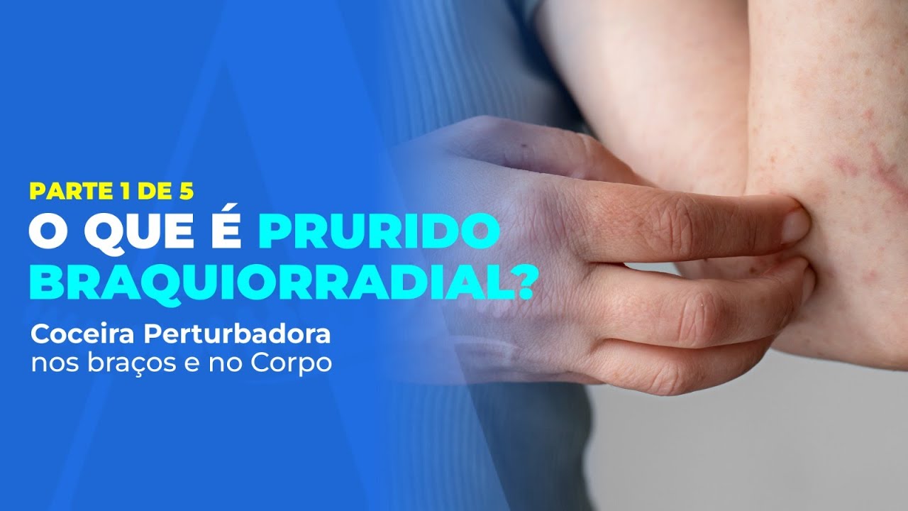 O Que é PRURIDO BRAQUIORRADIAL? Parte 1 de 5. Coceira Perturbadora no corpo. Depoimento Margarete
