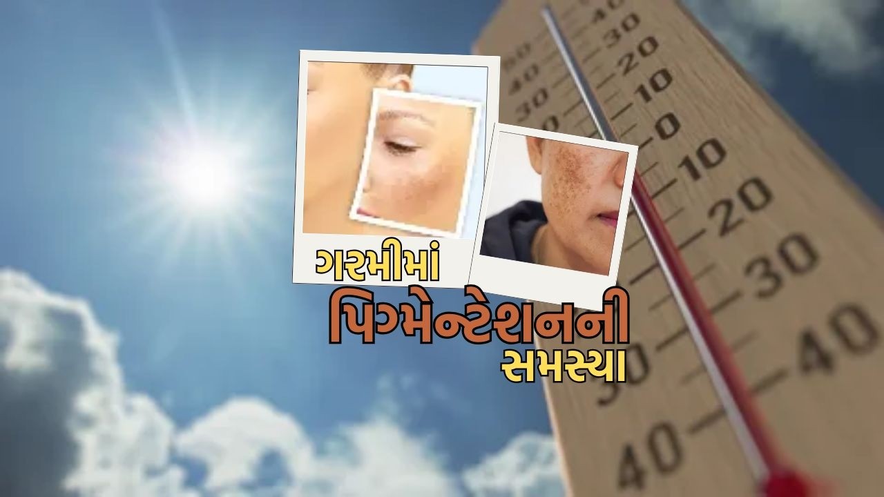 ગરમીમાં પિગ્મેન્ટેશનની સમસ્યા | Pigmentation problem in heat | GUJARATI NEWS BULLETIN