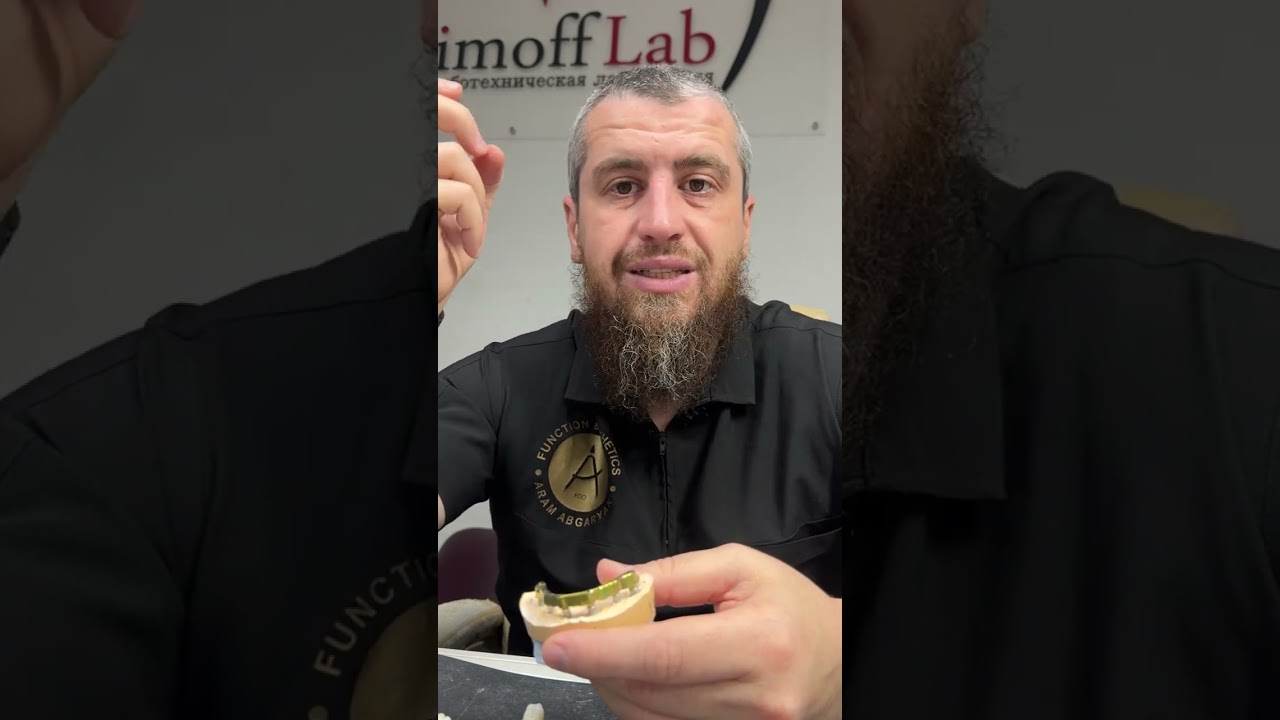 Циркониевые конструкции с титановой балкой на имплантатах.