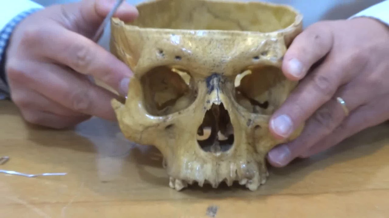 Persian Anatomy, Head & Neck آناتومی سر و گردن بزبان فارسی Skull/Frontal bone