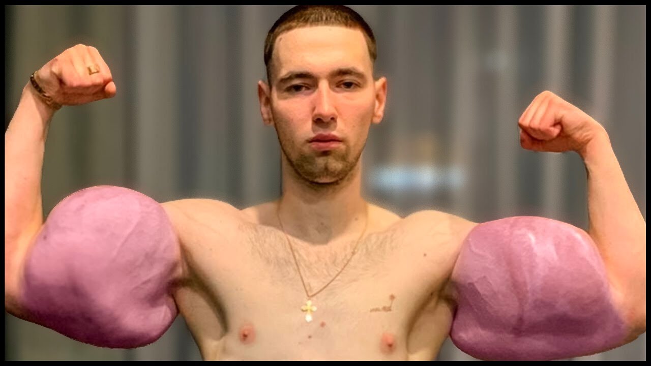 10 Weirdest Fake Bodybuilders Ever