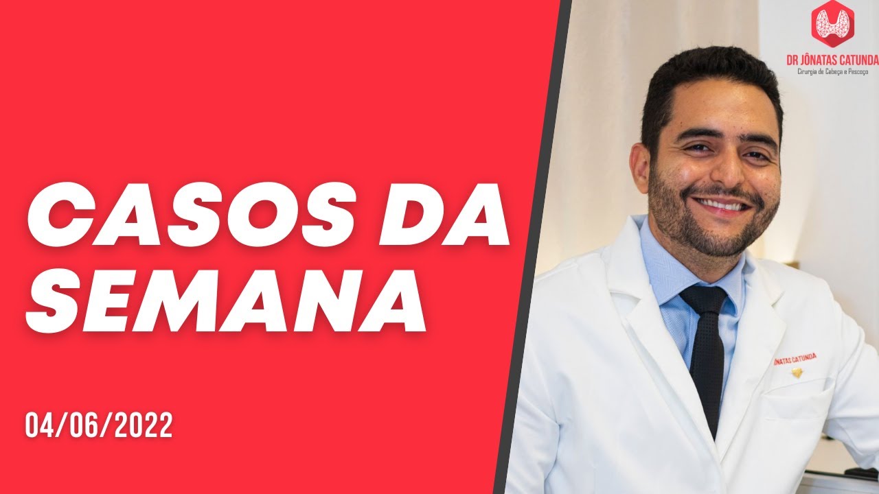 Casos da semana - Qualidade de vida, linfonodos, Hipertireoidismo, cancer de tireoide, tireoidite