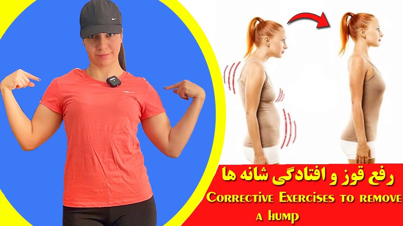 رفع قوز یا افتادگی شانه ها,Corrective exercises to remove hump