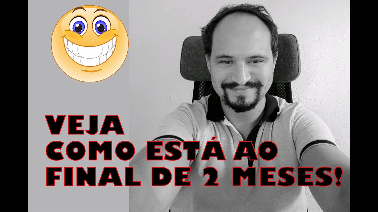 2 Months - Hair Transplant - Day by day evolution @emrahcinik