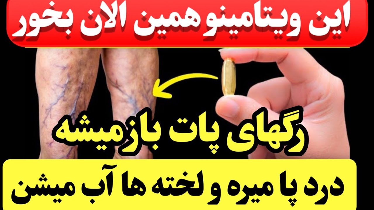 مراقب باشید؛ اگه این ۵ علامتو در پاهات داشتی فوراً این ویتامینو بخور ،لخته ها آب میشن 