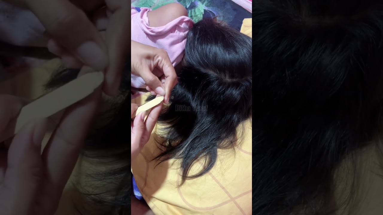 ASMR Lice, Suaranya renyah banget🤭
