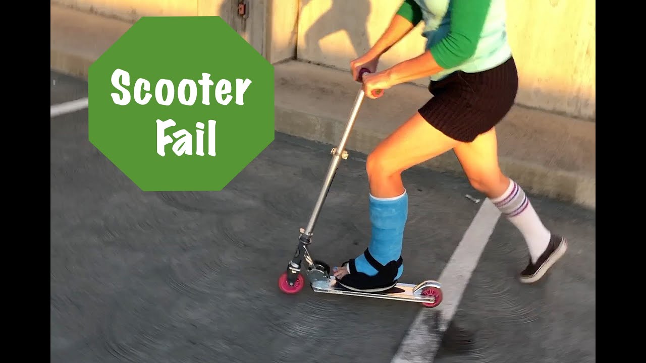 Scooter Fail - Now 2 Leg Casts!