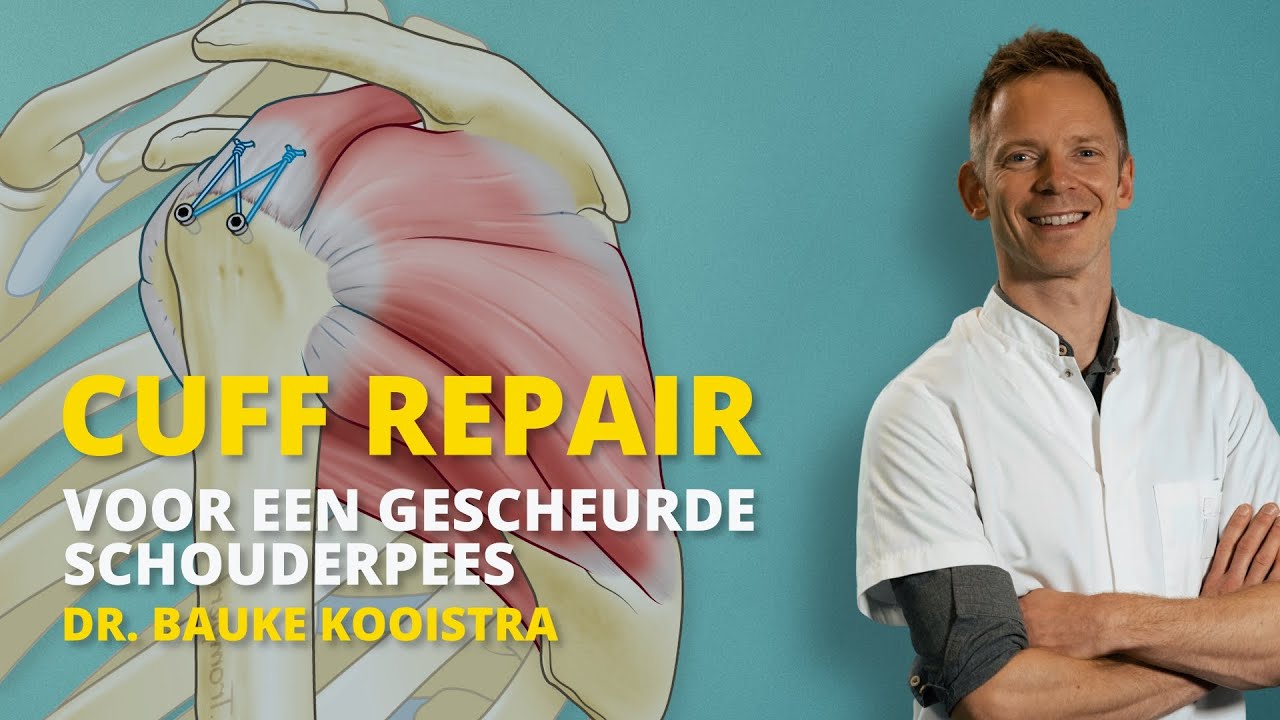 Cuff repair operatie voor gescheurde schouderpees