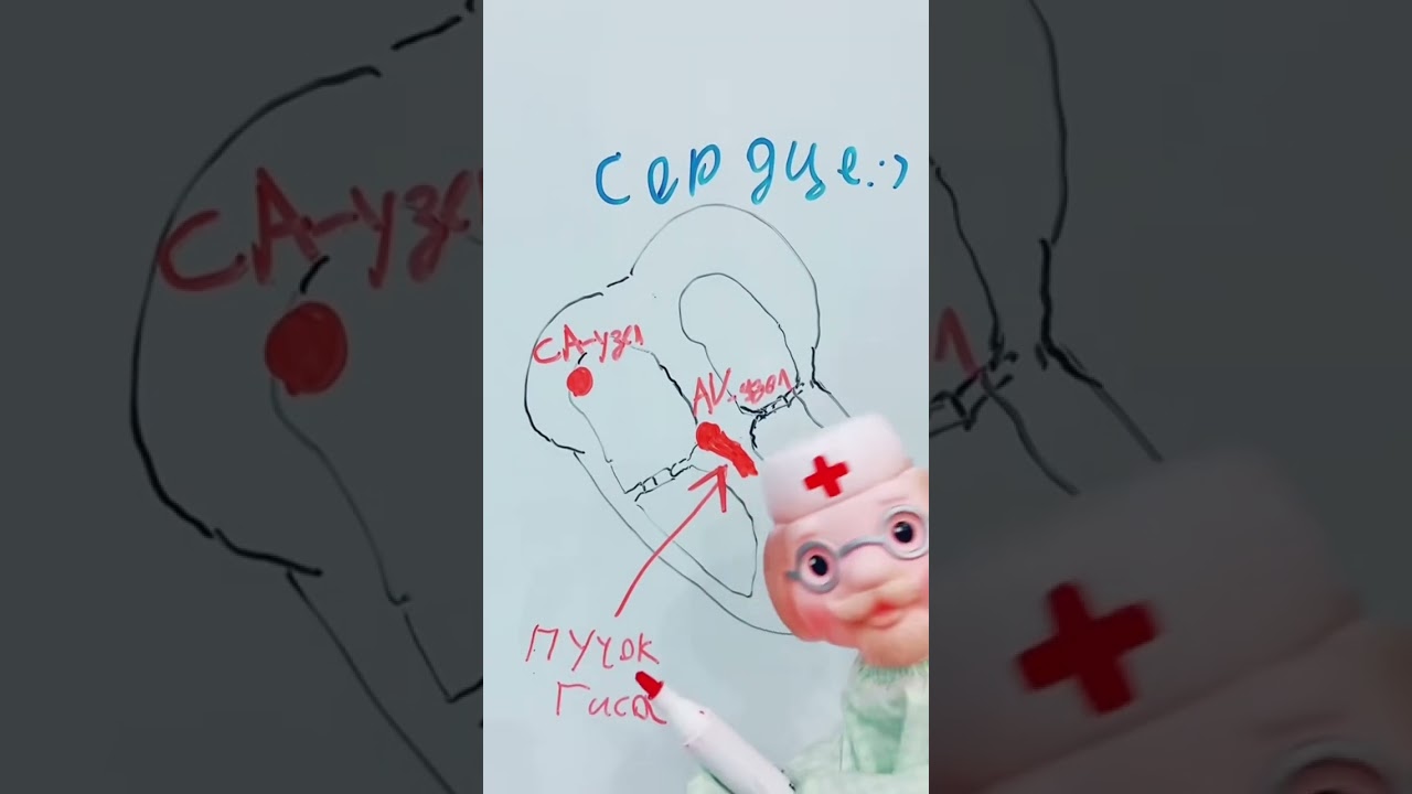 Блокада ножек пучка Гиса #медицина #shorts