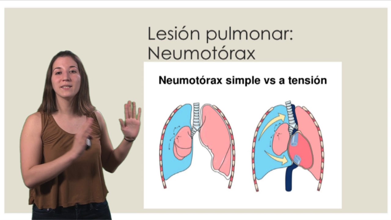 Trauma Torácico