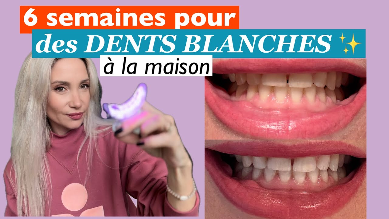 ⭐️DENTS BLANCHES : MON FABULEUX BEAUTY DEVICE 👌