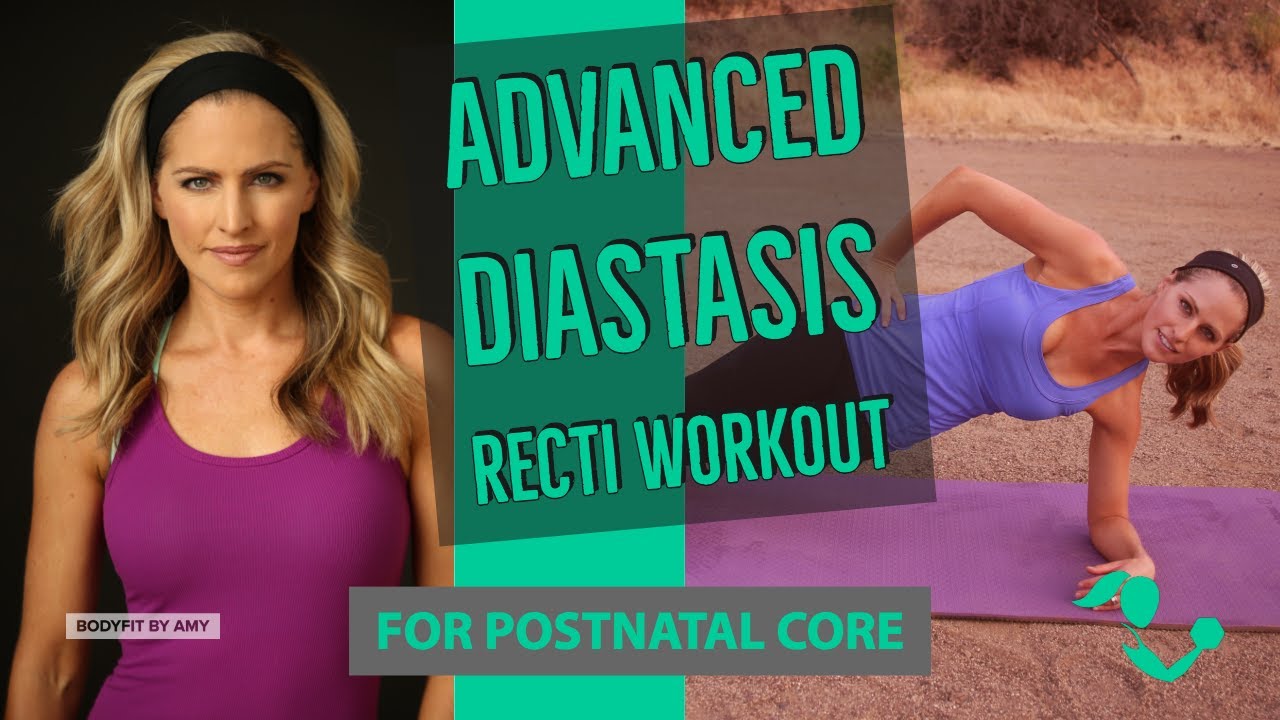 17 Minute Advanced Diastasis Recti Core Workout for Ab Separation After Pregnancy